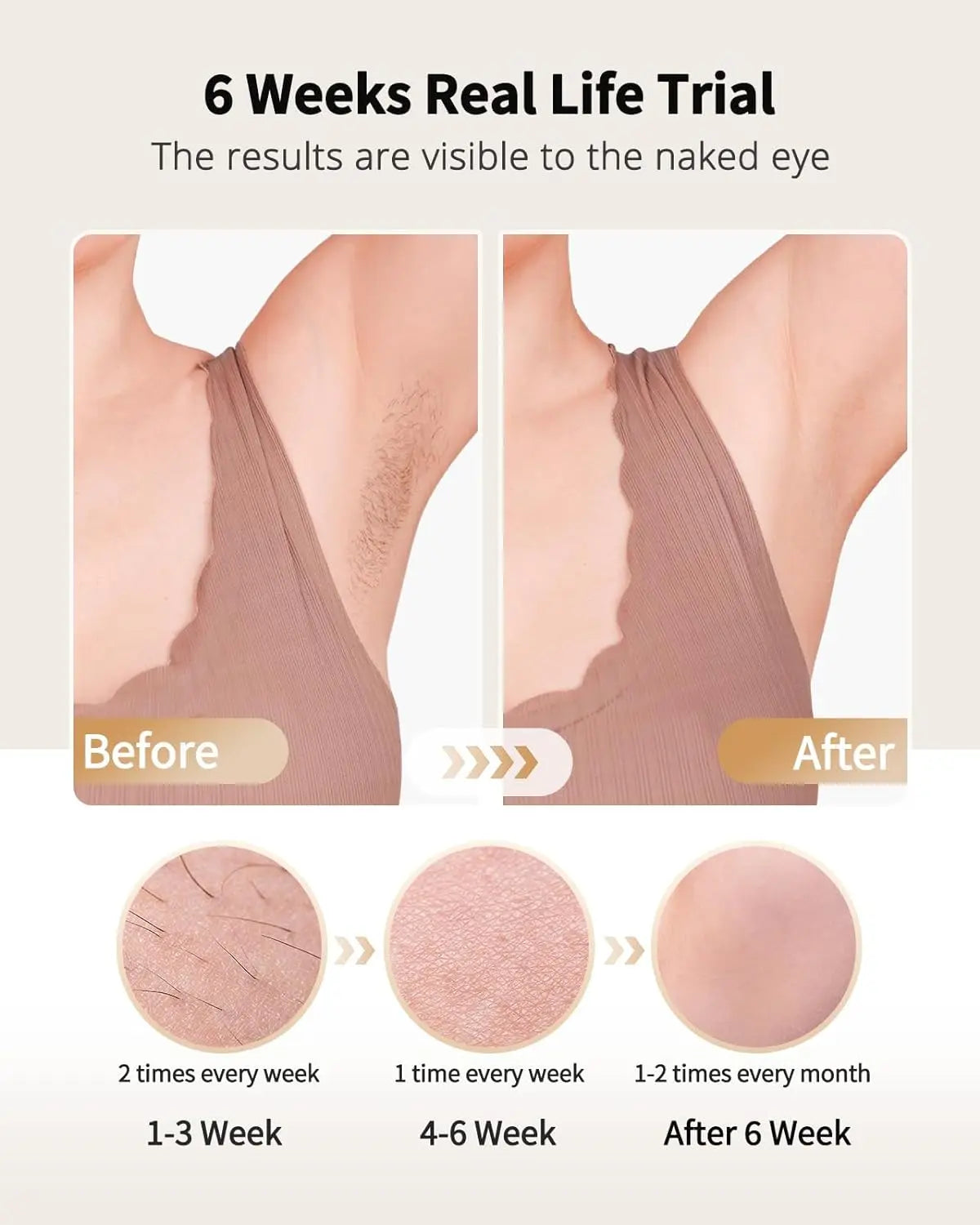 Laser Hair Removal with Ice Cooling Care Function for Women Men Permanent,Unlimited Flashes Painless Epilator IPL Hair Remover